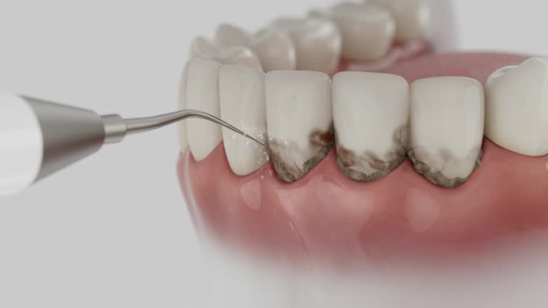Reliable Dental Implants contractor in Fox Point, WI by Smile Center Dentistry